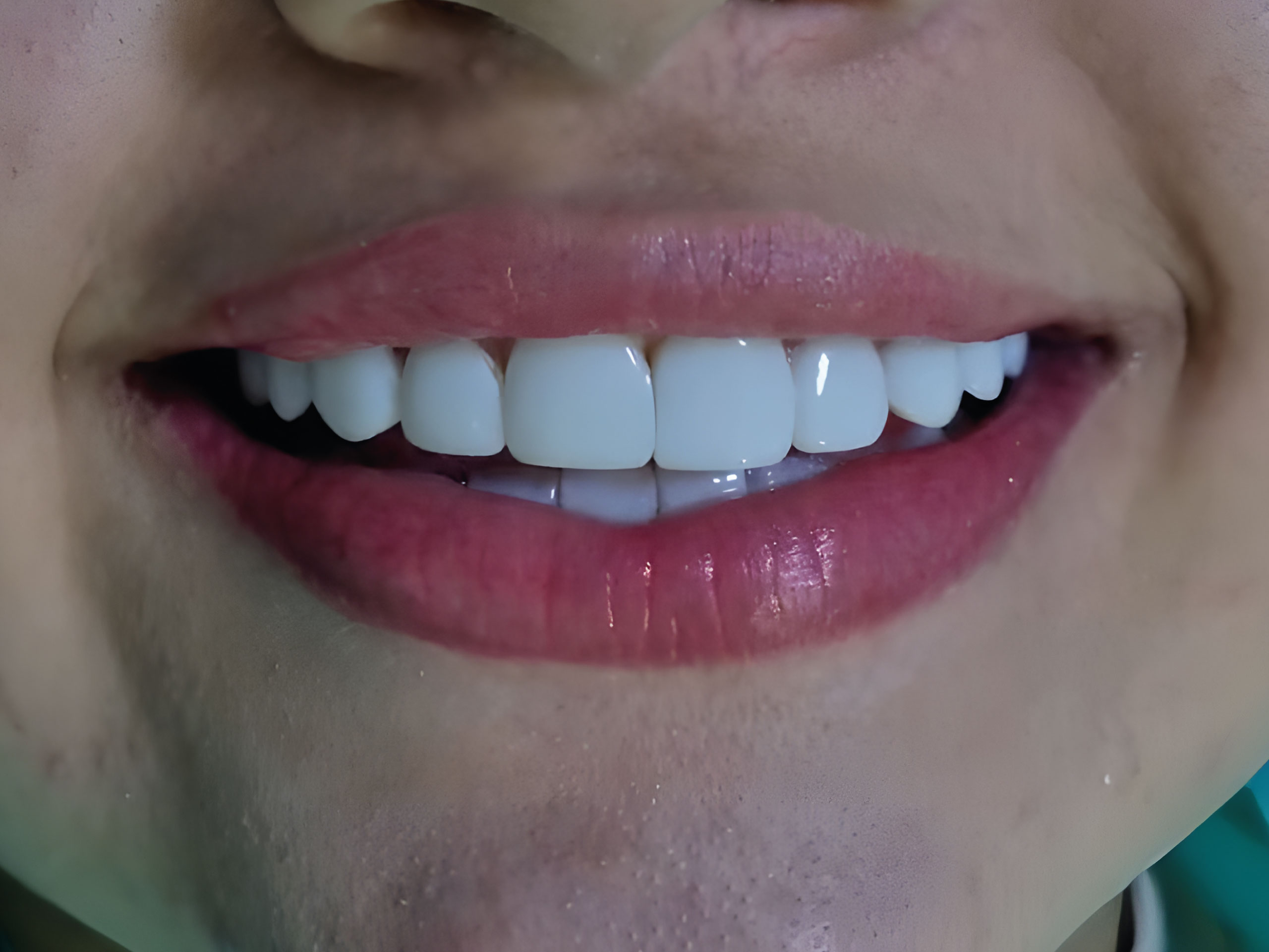 Clínica odontológica en Yopal: 20 años cuidando y transformando sonrisas